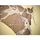 Immunohistochemistry - Anti-Cytokeratin 19 Antibody - Antibodies.com (A8223)