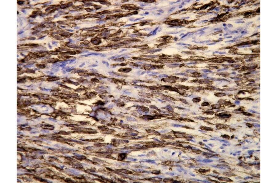 Immunohistochemistry - Anti-Cytokeratin 19 Antibody - Antibodies.com (A8223)