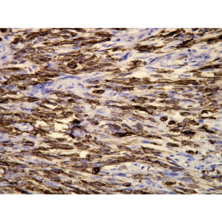 Immunohistochemistry - Anti-Cytokeratin 19 Antibody - Antibodies.com (A8223)
