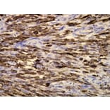 Immunohistochemistry - Anti-Cytokeratin 19 Antibody - Antibodies.com (A8223)