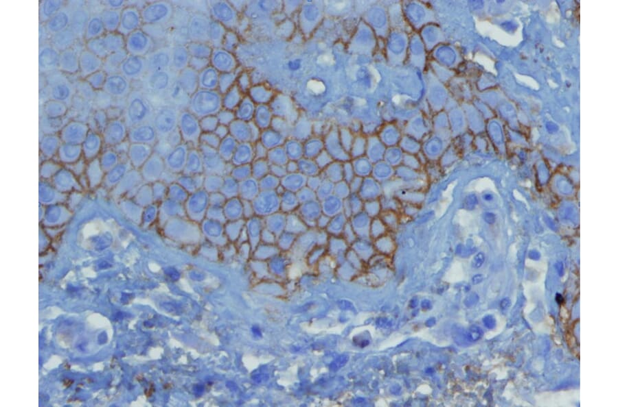 Immunohistochemistry - Anti-C3d Complement Antibody - Antibodies.com (A8224)