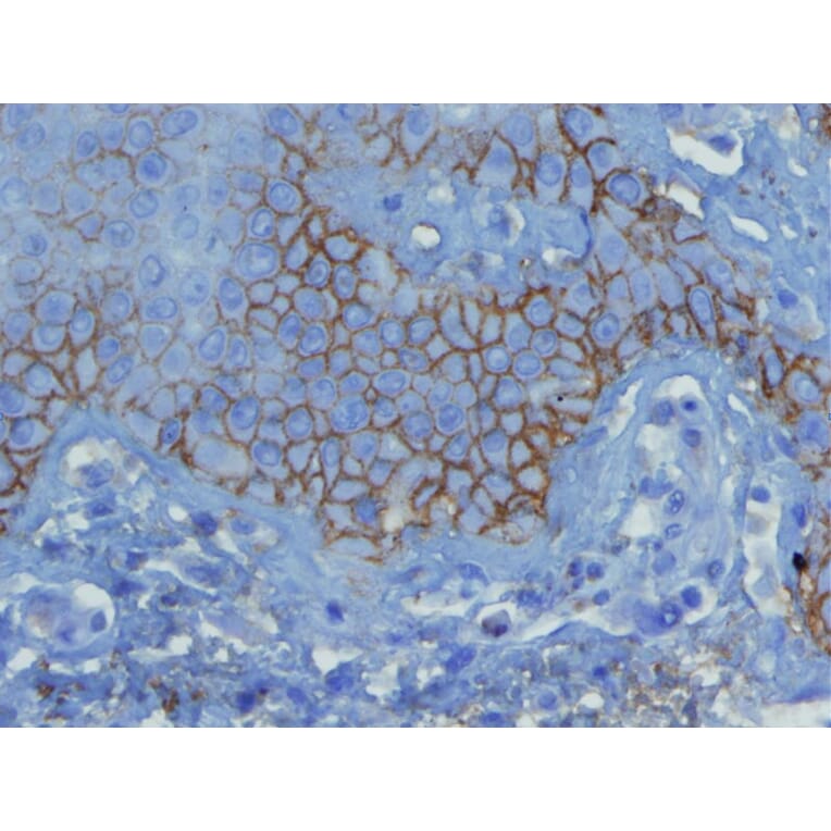 Immunohistochemistry - Anti-C3d Complement Antibody - Antibodies.com (A8224)