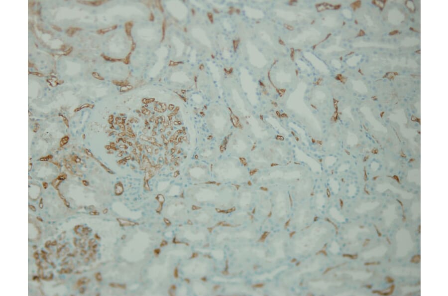 Immunohistochemistry - Anti-C4d complement Antibody - Antibodies.com (A8225)