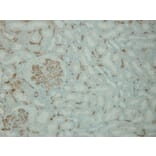 Immunohistochemistry - Anti-C4d complement Antibody - Antibodies.com (A8225)