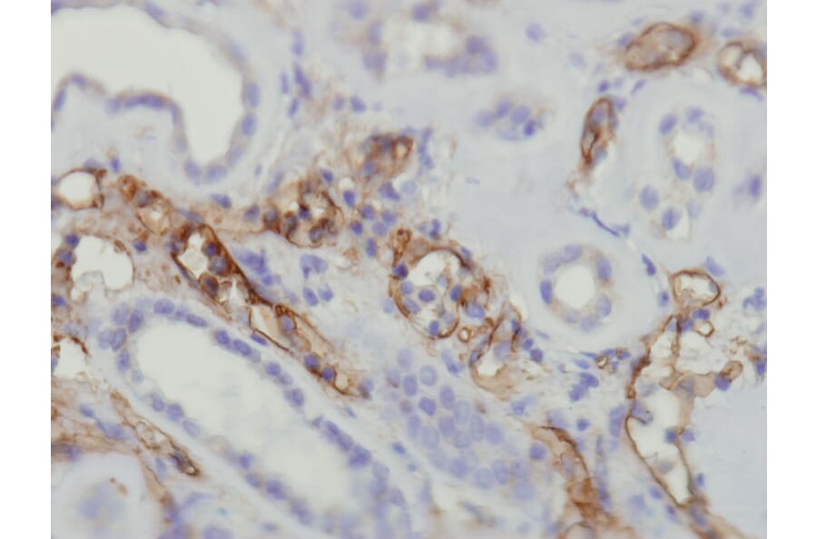 Immunohistochemistry - Anti-C4d complement Antibody - Antibodies.com (A8225)