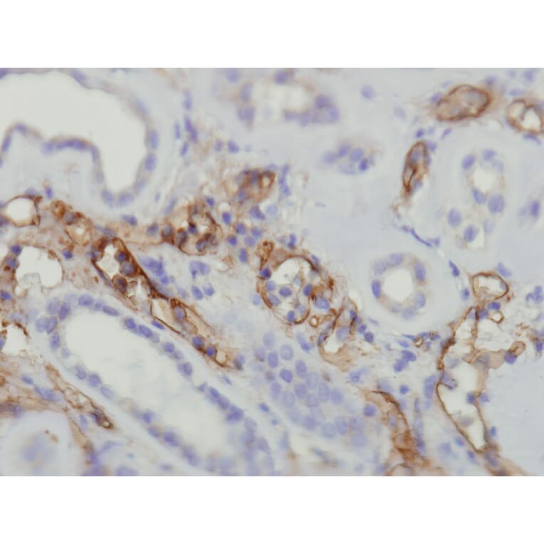 Immunohistochemistry - Anti-C4d complement Antibody - Antibodies.com (A8225)