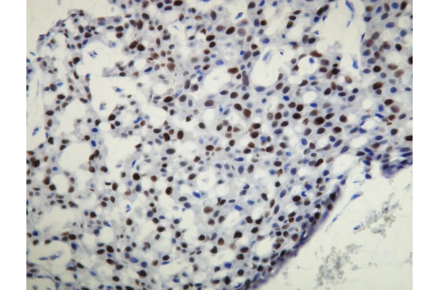 Immunohistochemistry - Anti-Progesterone Receptor Antibody - Antibodies.com (A8226)