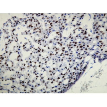 Immunohistochemistry - Anti-Progesterone Receptor Antibody - Antibodies.com (A8226)