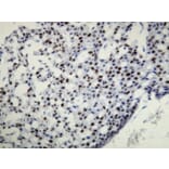 Immunohistochemistry - Anti-Progesterone Receptor Antibody - Antibodies.com (A8226)