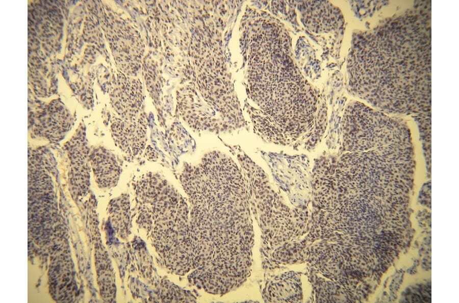 Immunohistochemistry - Anti-Progesterone Receptor Antibody - Antibodies.com (A8226)