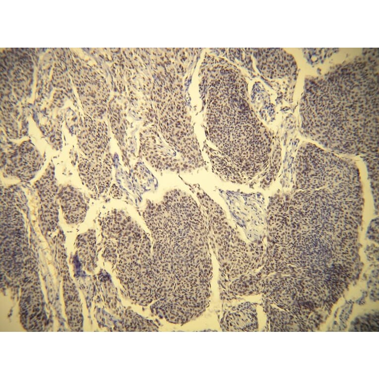 Immunohistochemistry - Anti-Progesterone Receptor Antibody - Antibodies.com (A8226)