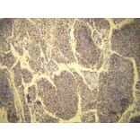 Immunohistochemistry - Anti-Progesterone Receptor Antibody - Antibodies.com (A8226)