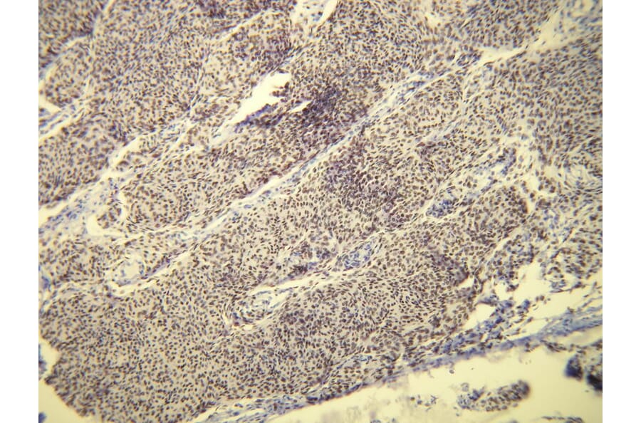 Immunohistochemistry - Anti-Progesterone Receptor Antibody - Antibodies.com (A8227)