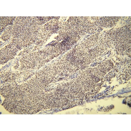 Immunohistochemistry - Anti-Progesterone Receptor Antibody - Antibodies.com (A8227)