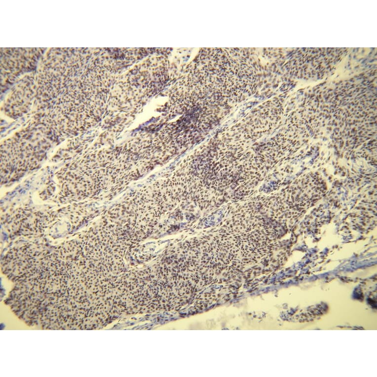Immunohistochemistry - Anti-Progesterone Receptor Antibody - Antibodies.com (A8227)