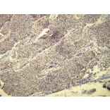 Immunohistochemistry - Anti-Progesterone Receptor Antibody - Antibodies.com (A8227)