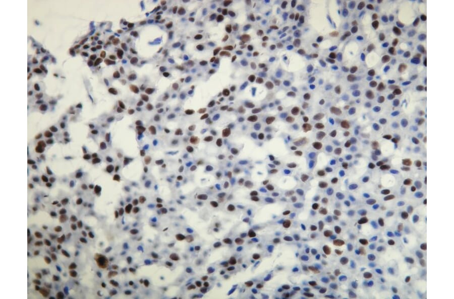 Immunohistochemistry - Anti-Progesterone Receptor Antibody - Antibodies.com (A8227)