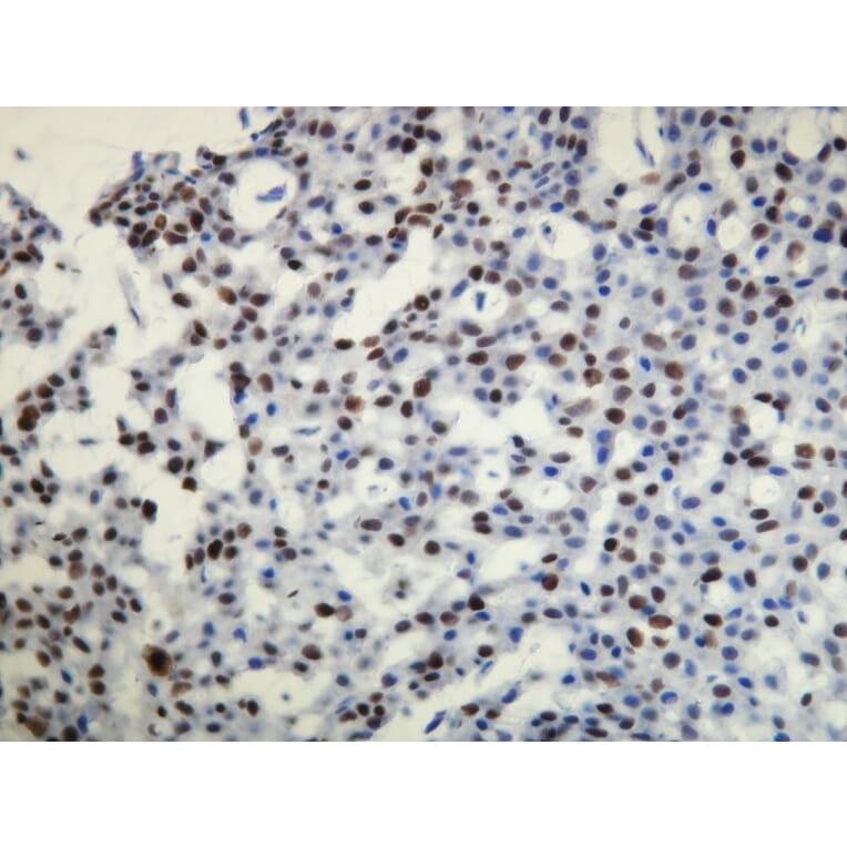 Immunohistochemistry - Anti-Progesterone Receptor Antibody - Antibodies.com (A8227)