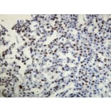 Immunohistochemistry - Anti-Progesterone Receptor Antibody - Antibodies.com (A8227)