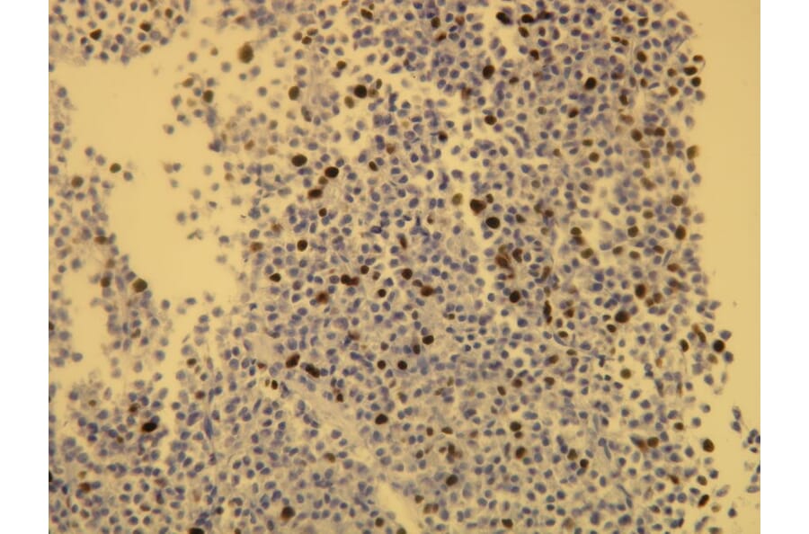 Immunohistochemistry - Anti-Ki-67 Antibody - Antibodies.com (A8228)