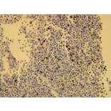 Immunohistochemistry - Anti-Ki-67 Antibody - Antibodies.com (A8228)