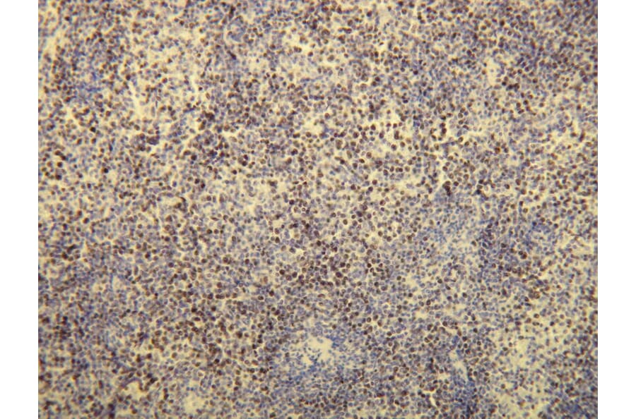 Immunohistochemistry - Anti-Ki-67 Antibody - Antibodies.com (A8228)