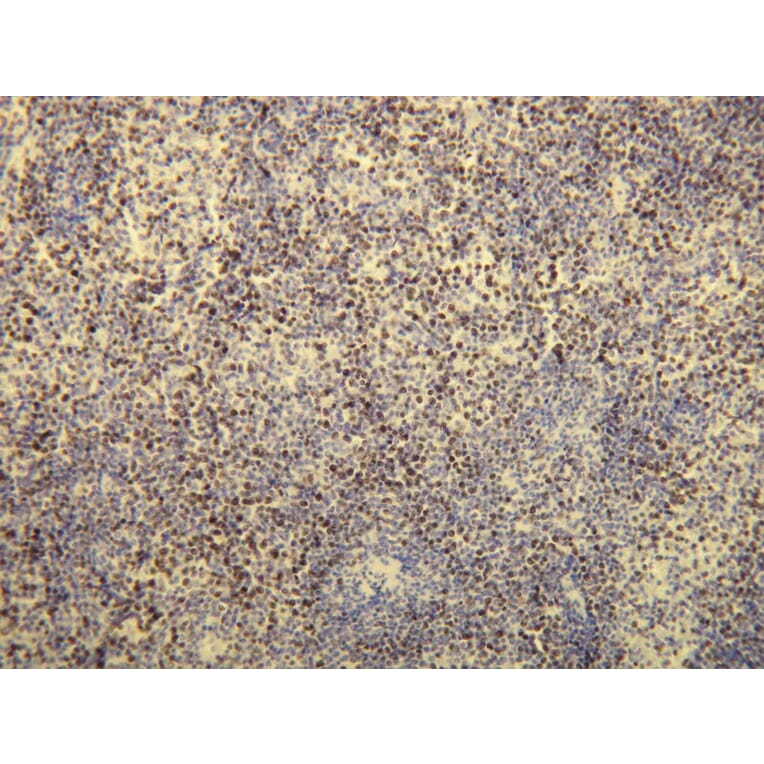 Immunohistochemistry - Anti-Ki-67 Antibody - Antibodies.com (A8228)