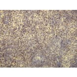 Immunohistochemistry - Anti-Ki-67 Antibody - Antibodies.com (A8228)