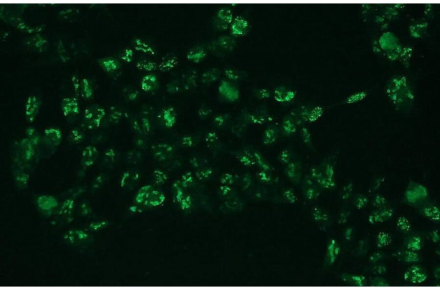 Immunocytochemistry - Anti-Ki-67 Antibody - Antibodies.com (A8228)