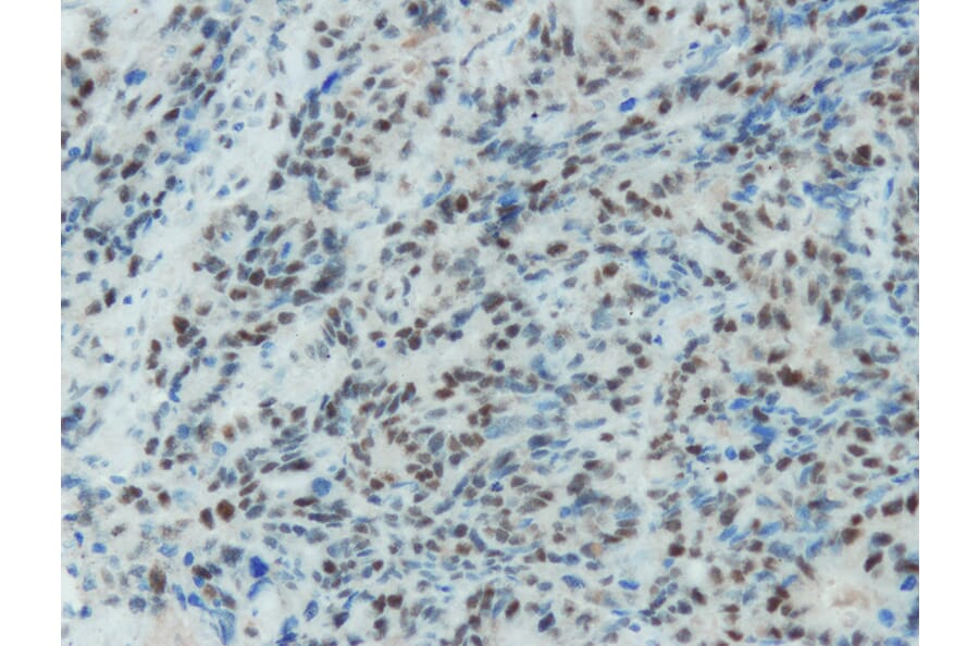 Immunohistochemistry - Anti-MSH2 Antibody - Antibodies.com (A8230)