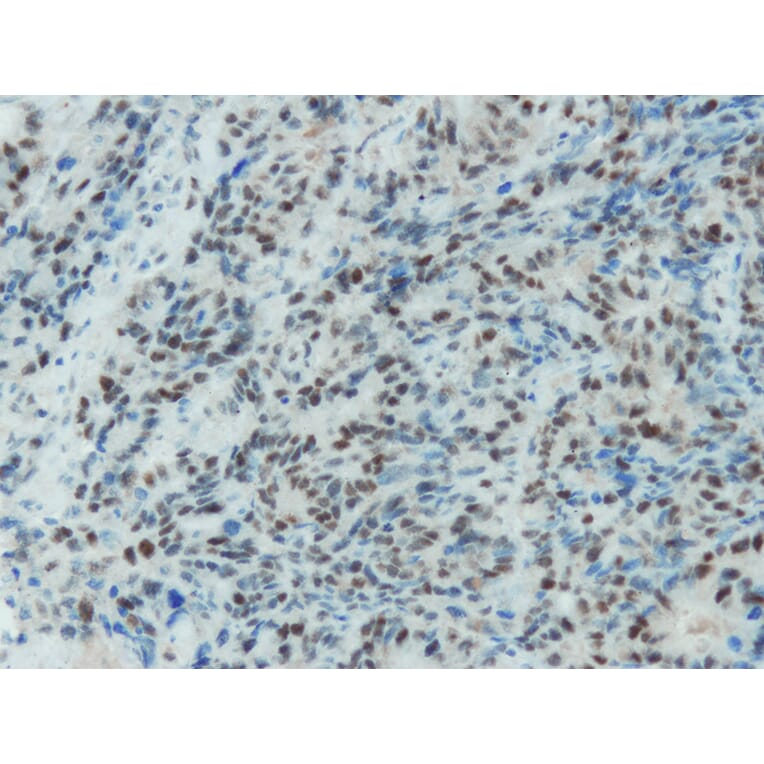 Immunohistochemistry - Anti-MSH2 Antibody - Antibodies.com (A8230)