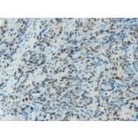 Immunohistochemistry - Anti-MSH2 Antibody - Antibodies.com (A8230)