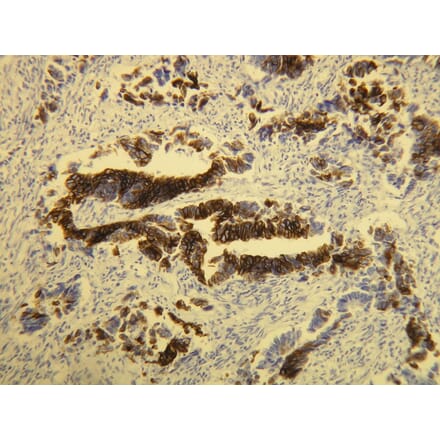 Immunohistochemistry - Anti-Cytokeratin 20 Antibody - Antibodies.com (A8231)
