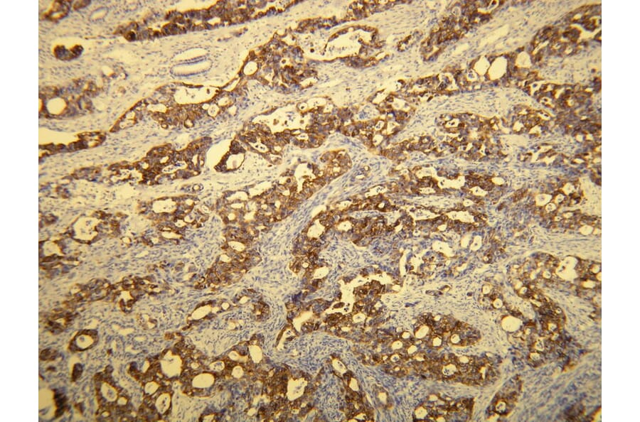 Immunohistochemistry - Anti-Cytokeratin 20 Antibody - Antibodies.com (A8231)