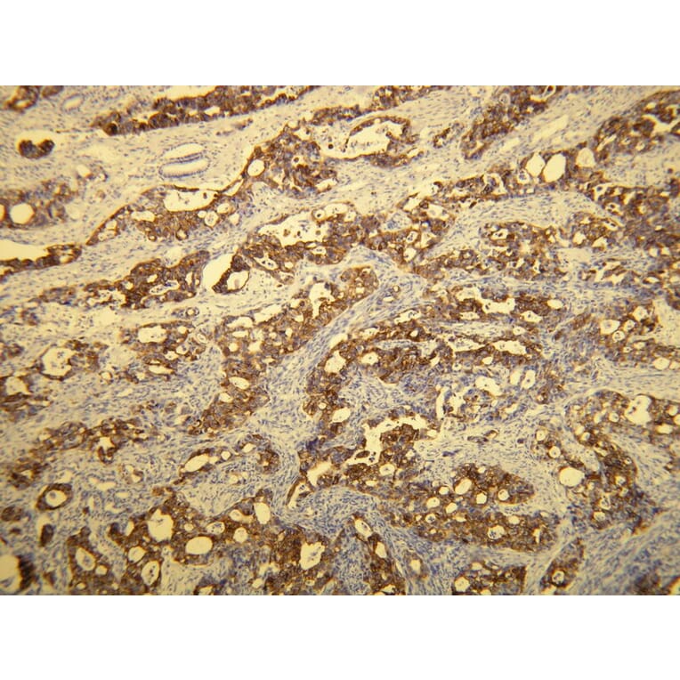 Immunohistochemistry - Anti-Cytokeratin 20 Antibody - Antibodies.com (A8231)