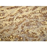 Immunohistochemistry - Anti-Cytokeratin 20 Antibody - Antibodies.com (A8231)