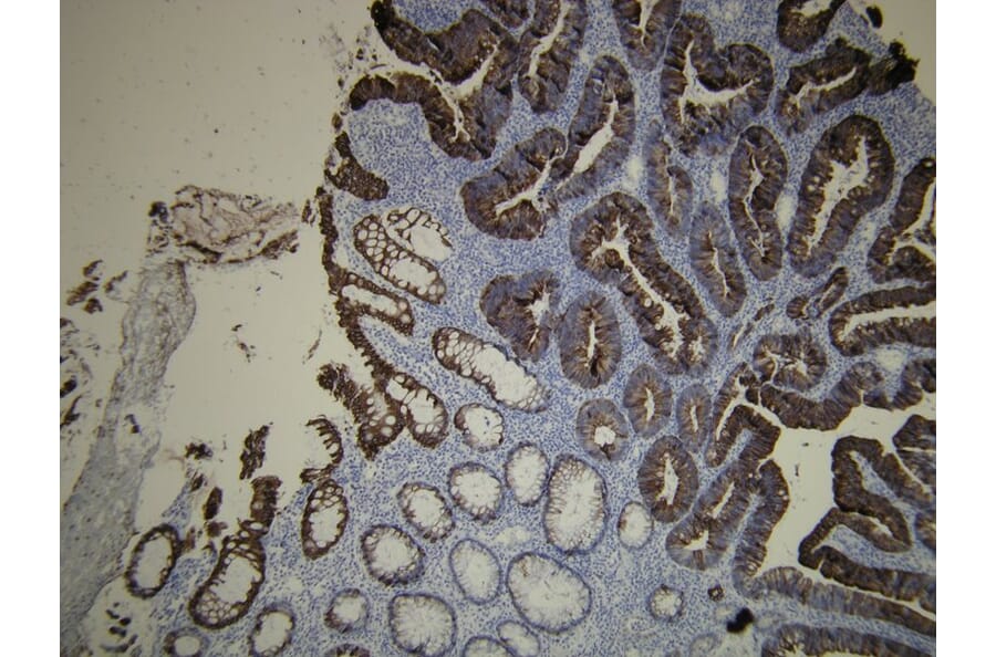 Immunohistochemistry - Anti-Cytokeratin 20 Antibody - Antibodies.com (A8231)