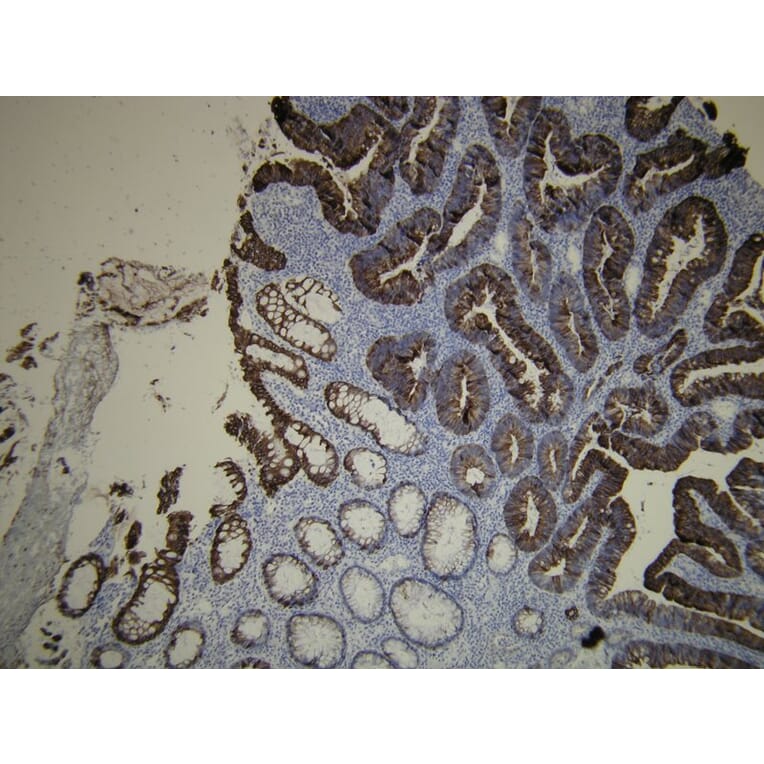 Immunohistochemistry - Anti-Cytokeratin 20 Antibody - Antibodies.com (A8231)