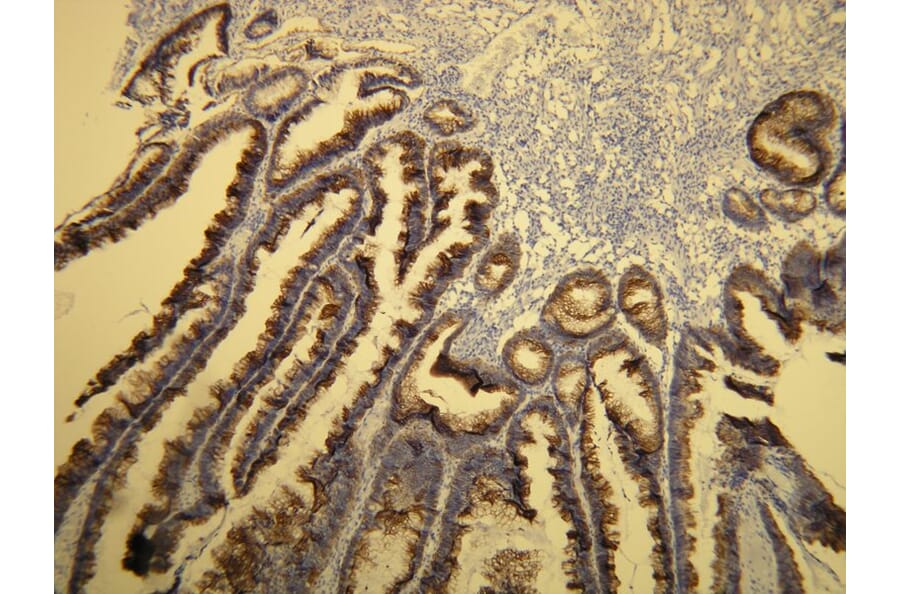 Immunohistochemistry - Anti-Cytokeratin 20 Antibody - Antibodies.com (A8231)
