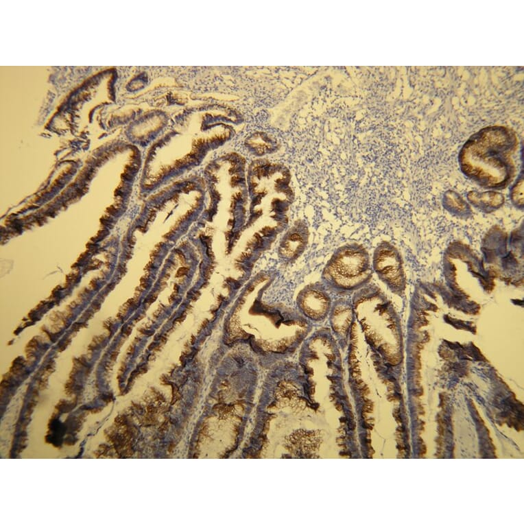 Immunohistochemistry - Anti-Cytokeratin 20 Antibody - Antibodies.com (A8231)