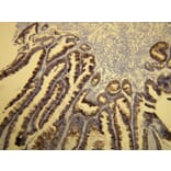 Immunohistochemistry - Anti-Cytokeratin 20 Antibody - Antibodies.com (A8231)