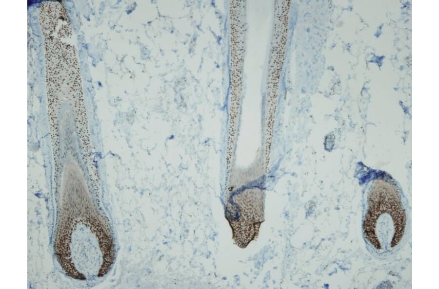 Immunohistochemistry - Anti-p63 Antibody - Antibodies.com (A8232)