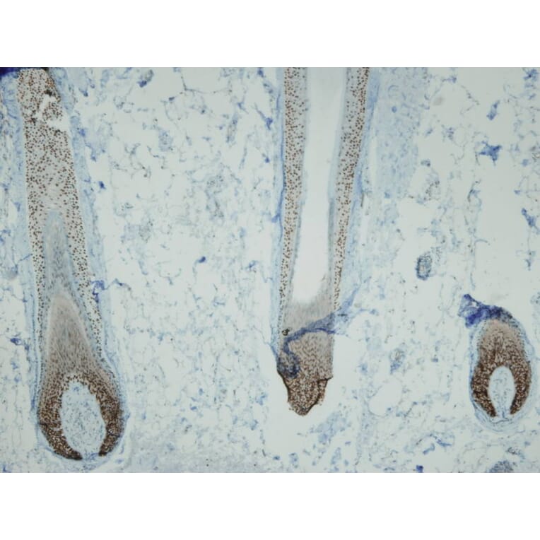 Immunohistochemistry - Anti-p63 Antibody - Antibodies.com (A8232)