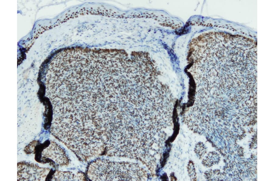 Immunohistochemistry - Anti-p63 Antibody - Antibodies.com (A8232)