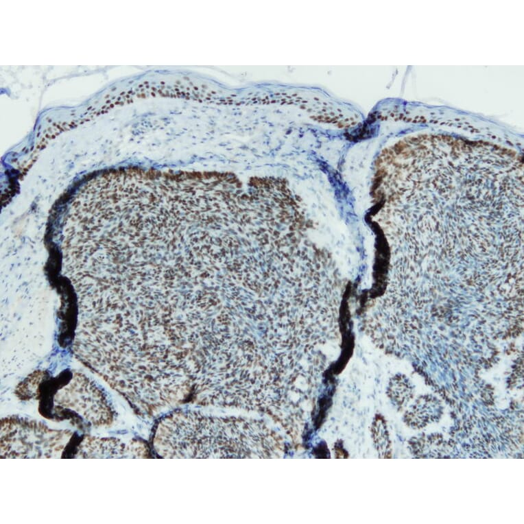 Immunohistochemistry - Anti-p63 Antibody - Antibodies.com (A8232)