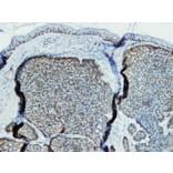 Immunohistochemistry - Anti-p63 Antibody - Antibodies.com (A8232)