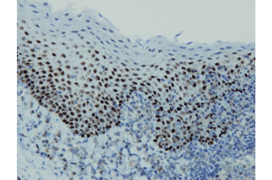 Immunohistochemistry - Anti-p63 Antibody - Antibodies.com (A8232)