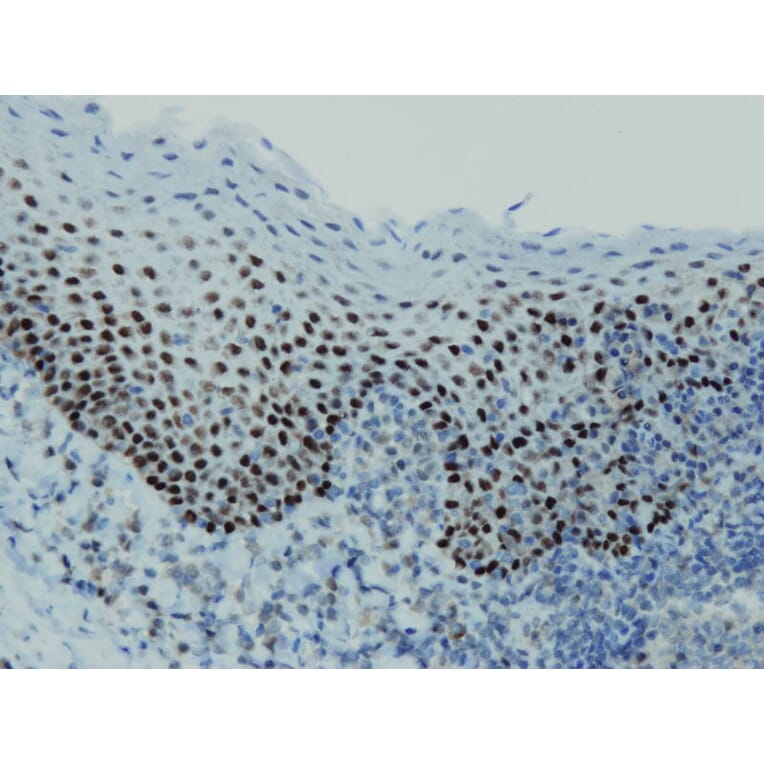 Immunohistochemistry - Anti-p63 Antibody - Antibodies.com (A8232)