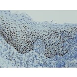 Immunohistochemistry - Anti-p63 Antibody - Antibodies.com (A8232)