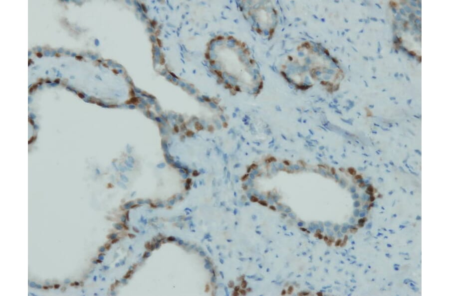 Immunohistochemistry - Anti-p63 Antibody - Antibodies.com (A8232)